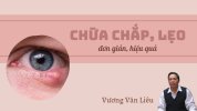 chua-chap-leo-mat-don-gian-va-hieu-qua.jpg