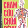 Châm cứu chữa bệnh
