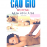 Cạo gió trị bệnh qua hình ảnh