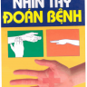 Nhìn tay đoán bệnh