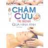 Châm cứu trị bệnh qua hình ảnh